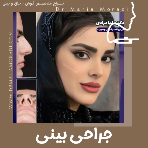 rhinoplasty-10