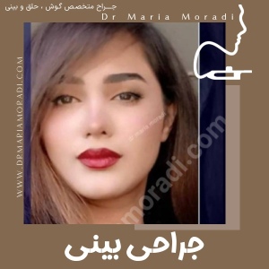 rhinoplasty-20