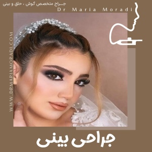 rhinoplasty-22