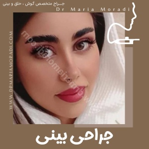 rhinoplasty-23
