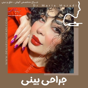 rhinoplasty-33
