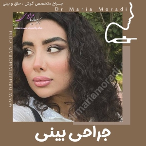 rhinoplasty-34