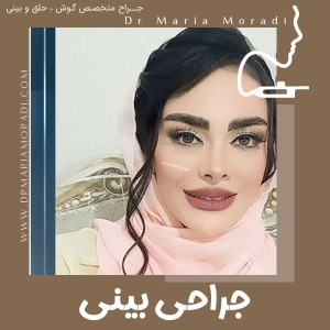 rhinoplasty-5