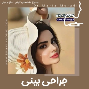 rhinoplasty-7