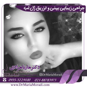 جراحی زیبایی بینی و تزریق ژل لب توسط دکتر ماریا مرادی