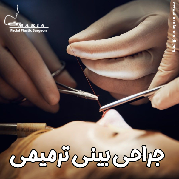 جراحی ترمیمی بینی - دکتر ماریا مرادی