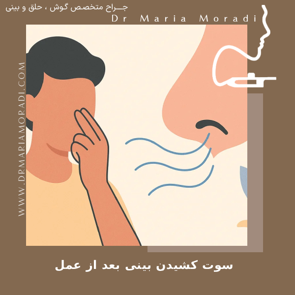 سوت کشیدن بینی بعد از عمل